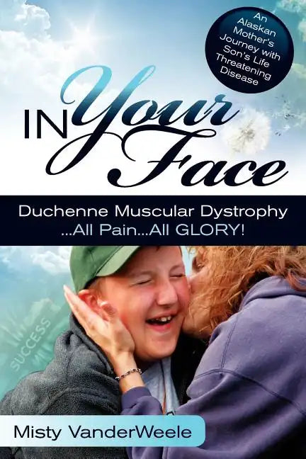 In Your Face Duchenne Muscular Dystrophy All Pain All Glory - Paperback