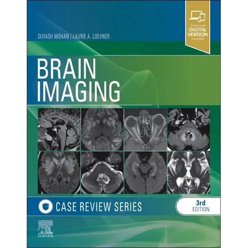 Brain Imaging: Case Review Series - Paperback