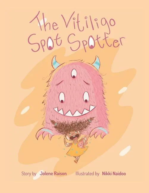 The Vitiligo Spot Spotter - Paperback