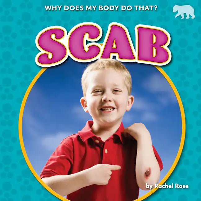 Scab - Paperback