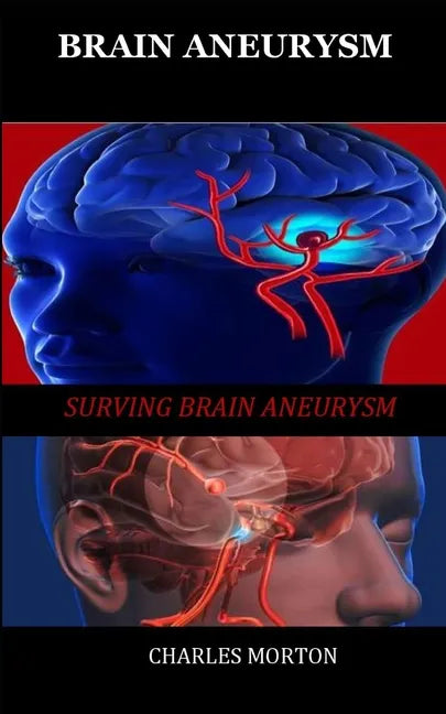Brain Aneurysm: Surviving Aneurysm - Paperback