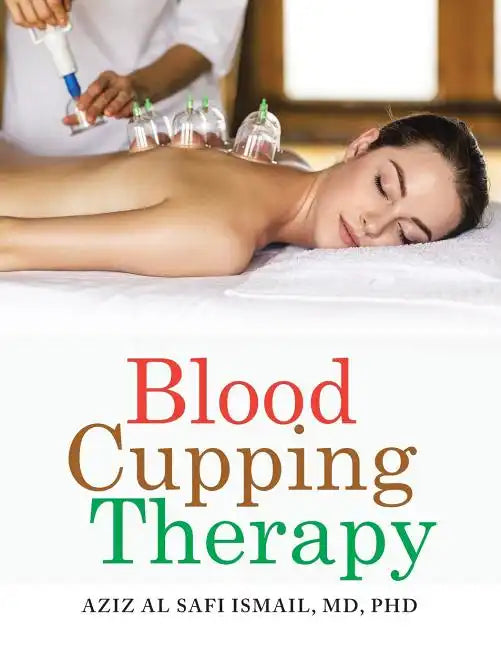Blood Cupping Therapy - Paperback
