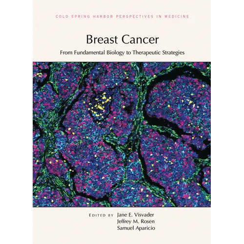 Breast Cancer: From Fundamental Biology to Therapeutic Strategies - Hardcover