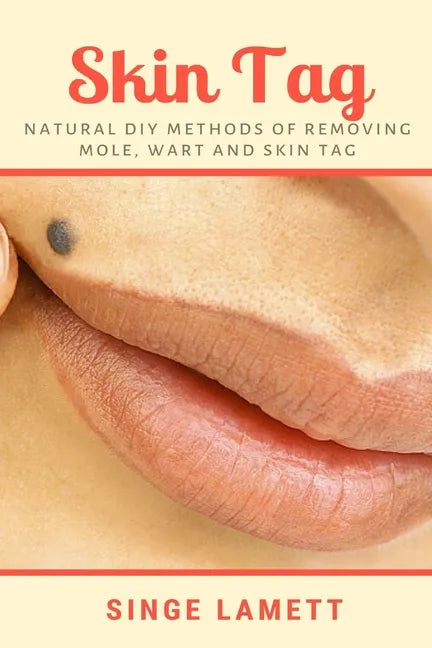 Skin Tag: Natural DIY Methods of removing Mole, Wart and Skin Tag - Paperback