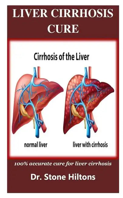 Liver Cirrhosis Cure: 100% accurate cure for liver cirrhosis - Paperback